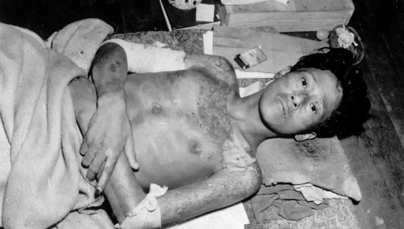 80 Yıl Sonra Nagasaki’den Uyarı: Nükleer Felaket Tehlikesi Hızla Yaklaşıyor!